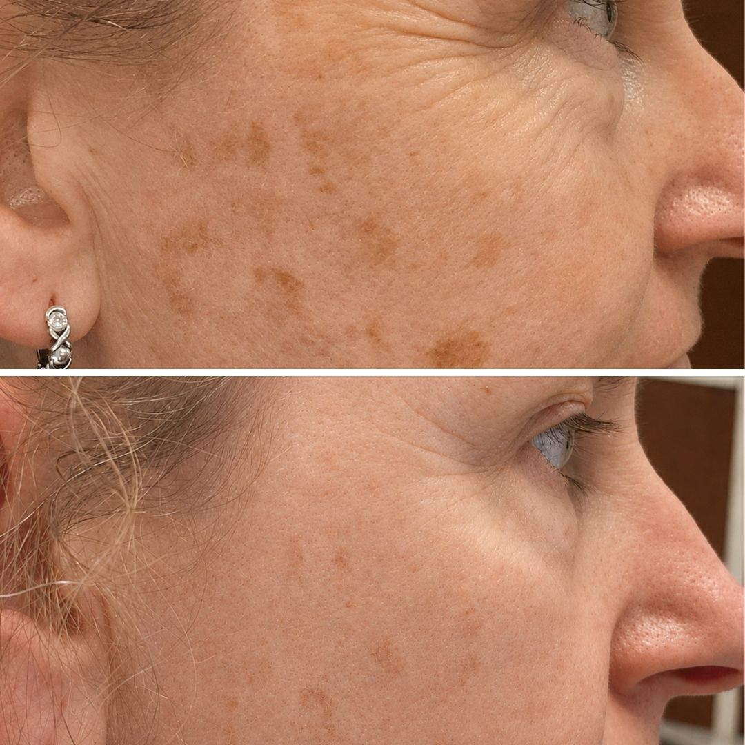 Essence: Hydrating Hyaluronic Acid & Ceramide Serum