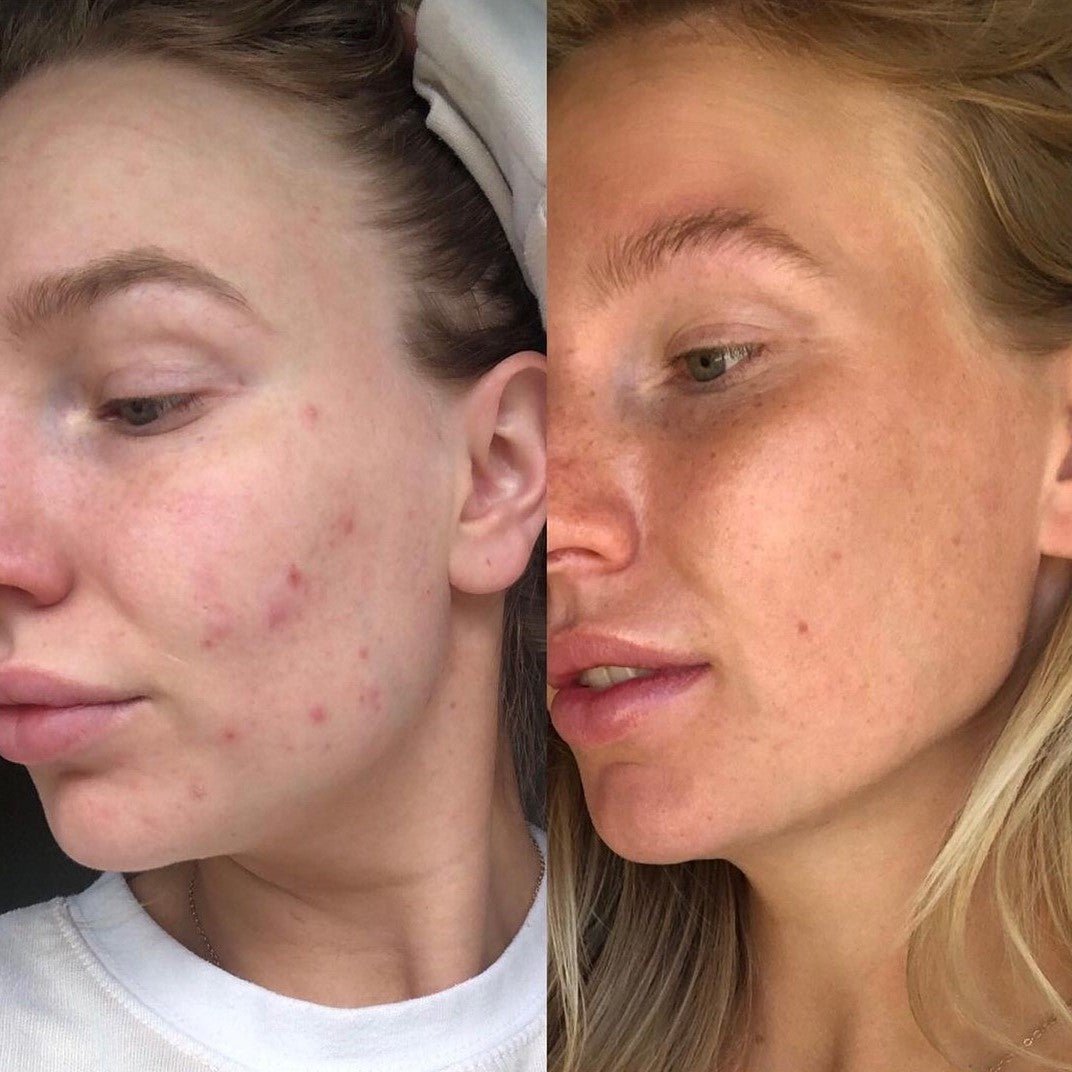 Real stories, real results: RAWKANVAS skincare transformations - RAWKANVAS NZ