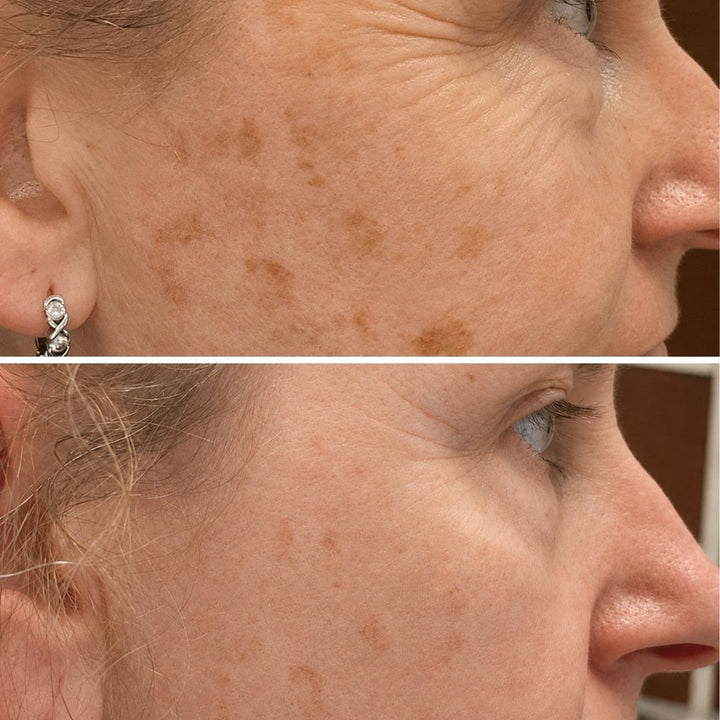 Purified: Purifying Cleanser