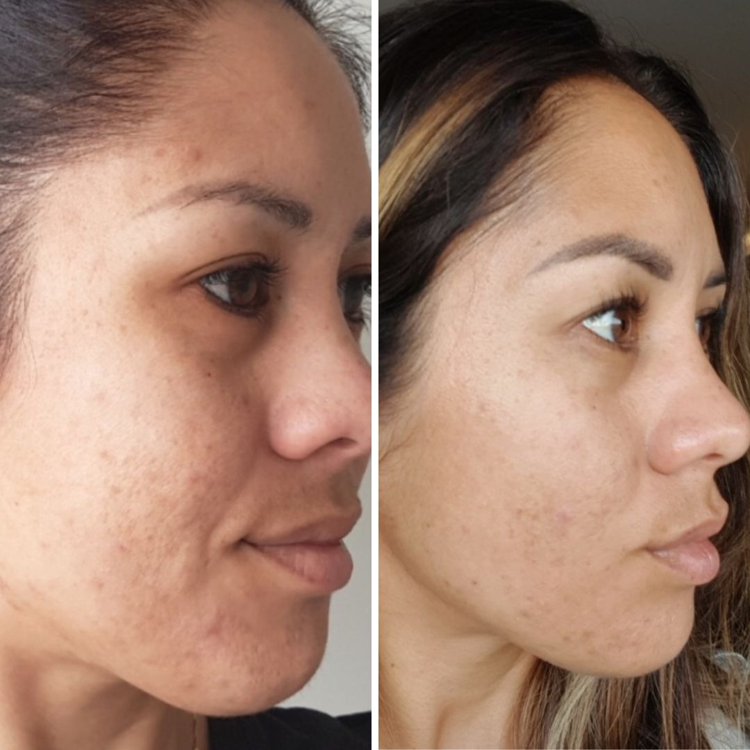 Yester Youth: Renewing Facial Oil - RAWKANVAS NZ